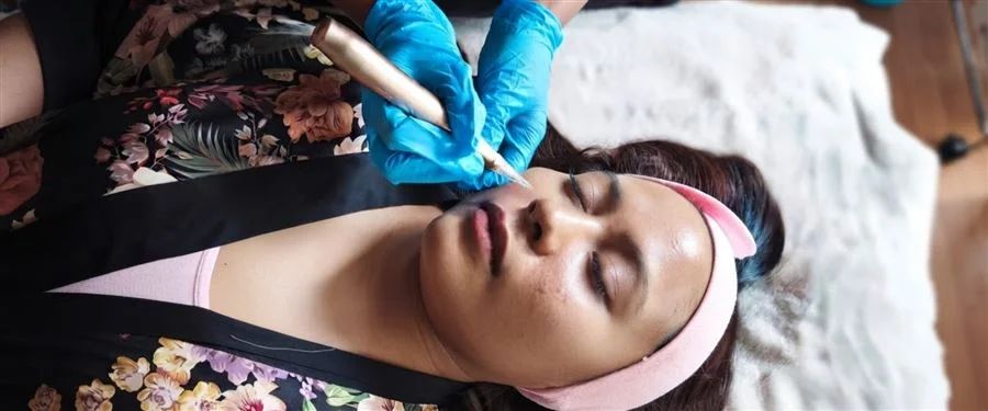 Rejuvenecimiento con Micro Needling en Nemiia Spa Condesa CDMX
